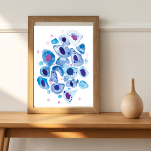 Bronchial Wash Pathology, Pulmonology Art Print