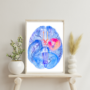 Meningioma Brain Anatomy Watercolor Art Print