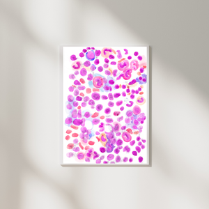 Acute Lymphoblastic Leukemia Hematooncology Art Print