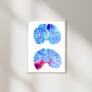 Stroke Art, Pathology Wall Decor, Neurology Print