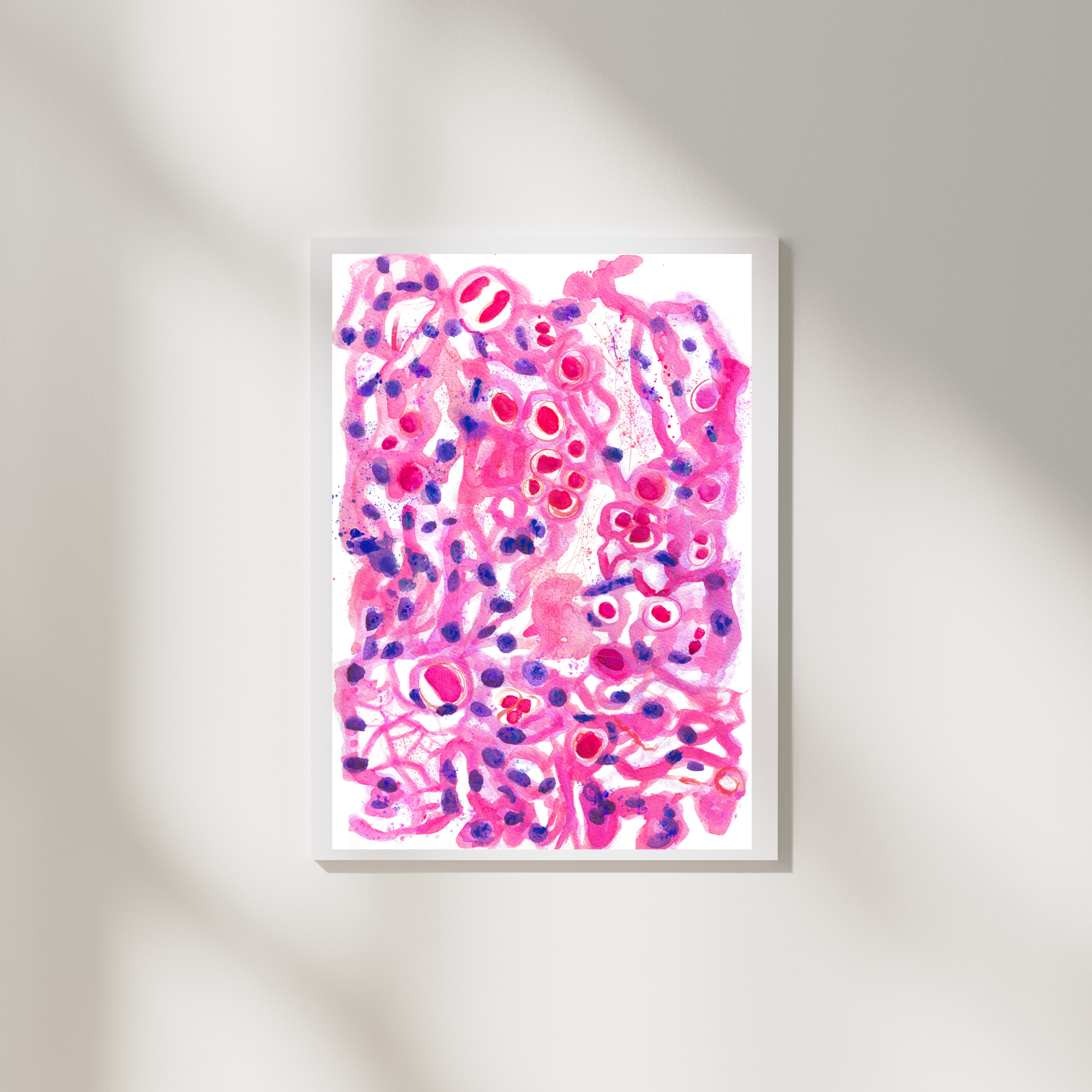 brain tumor pathology painting