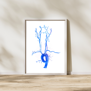 Carotid Angiography Post Stenting Watercolor Art Print