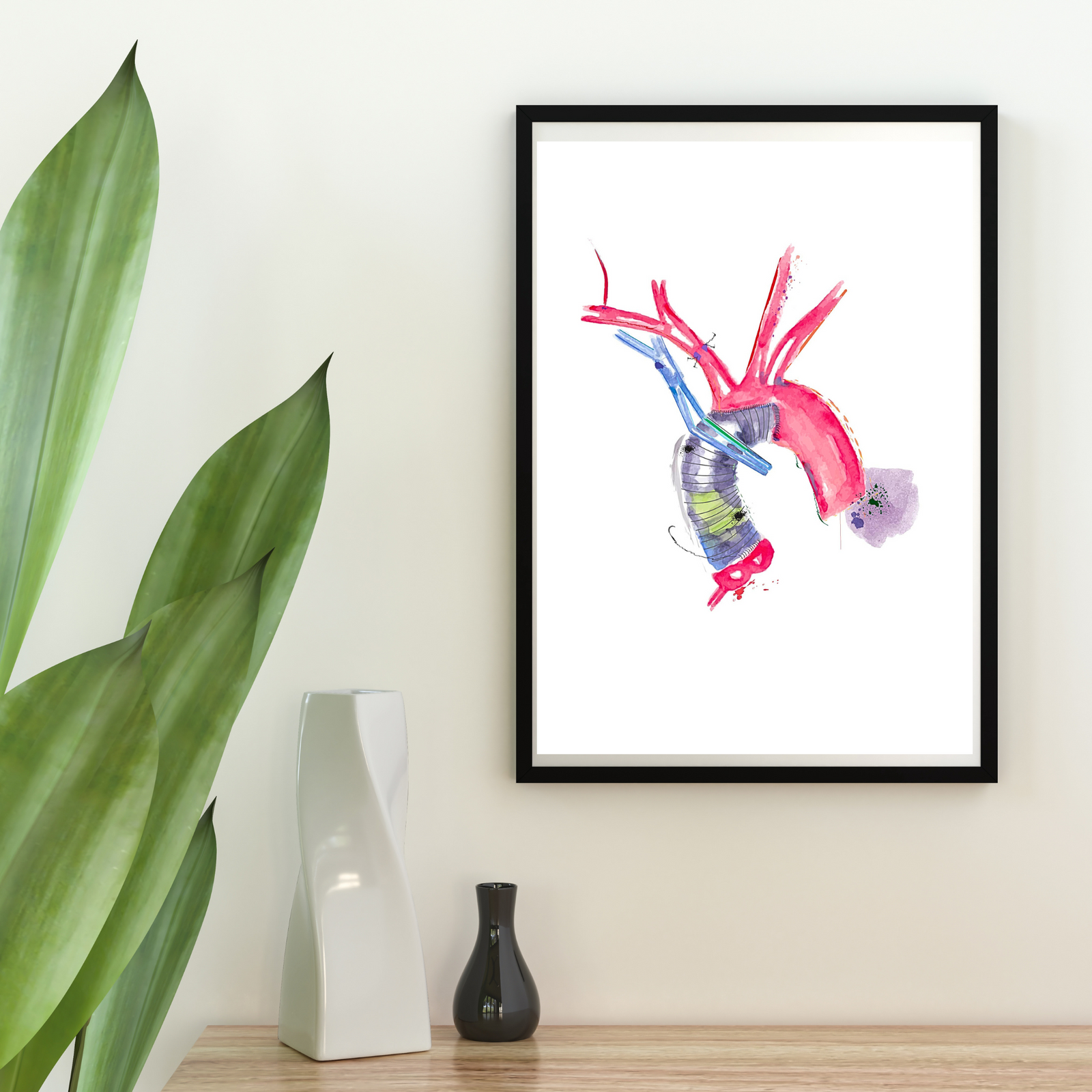 Aorta Aneurysm Repair Art Print