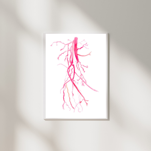 Angiography Femoral Spf Artery Occlusion Anatomy Art Print