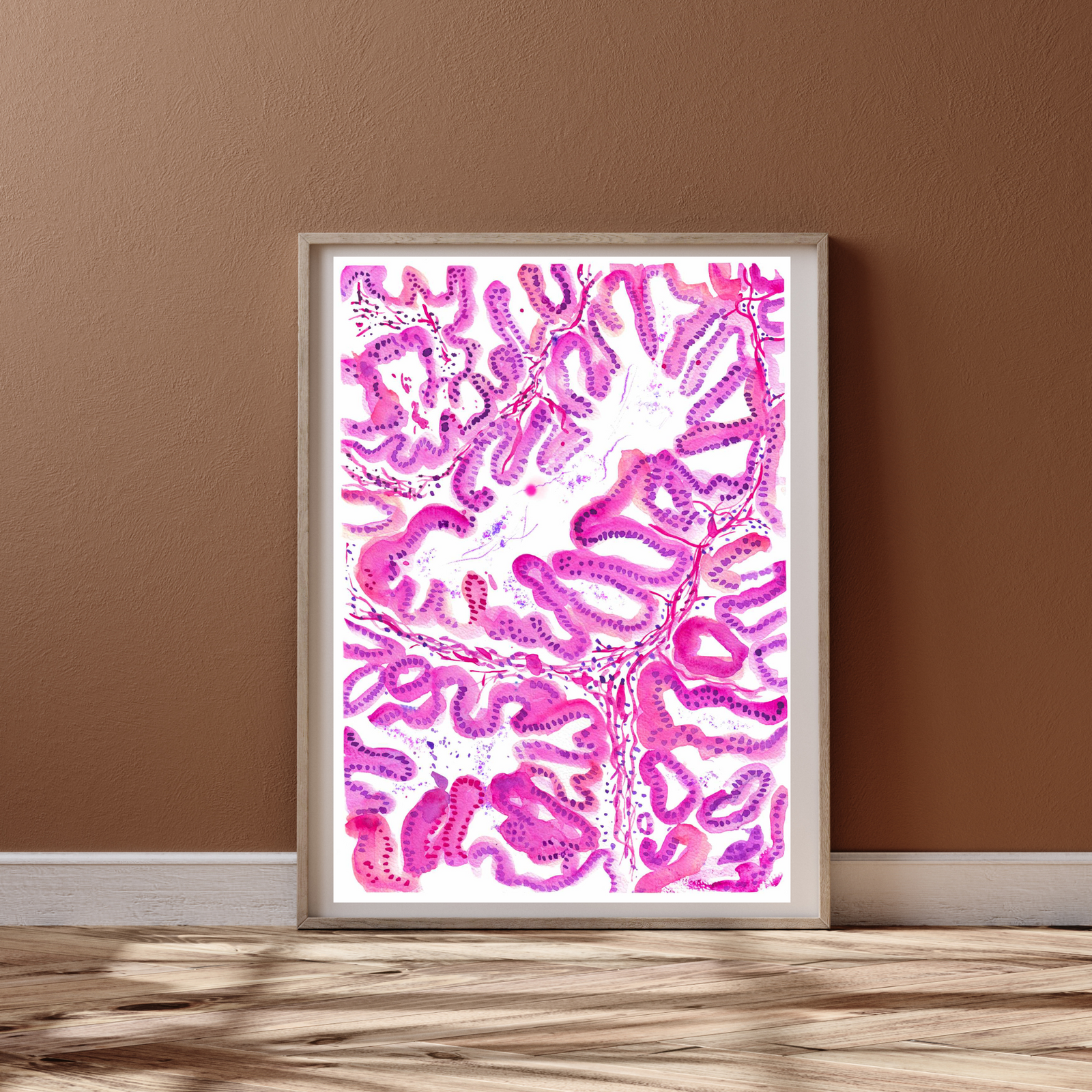 Endometrial Cancer Art Print