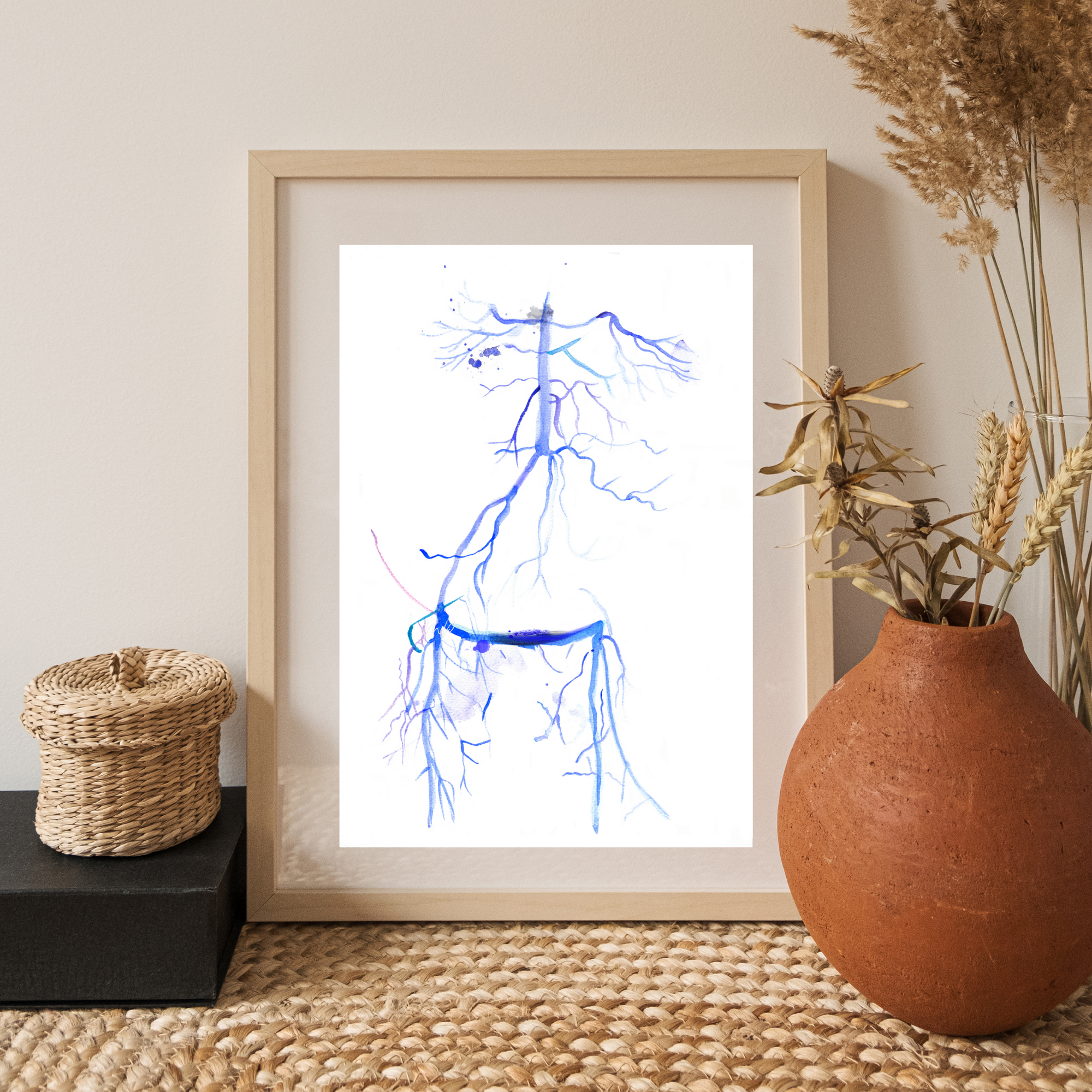 Crossover iliac artery bypass