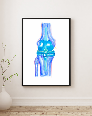 Knee Replacement Orthopedic Surgery Art