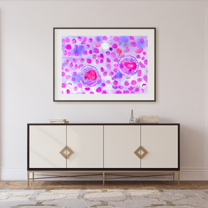 Hodgkin Lymphoma Watercolor Art Print