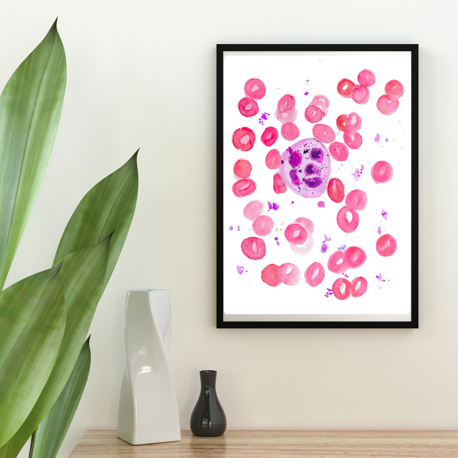 Megaloblastic Anemia