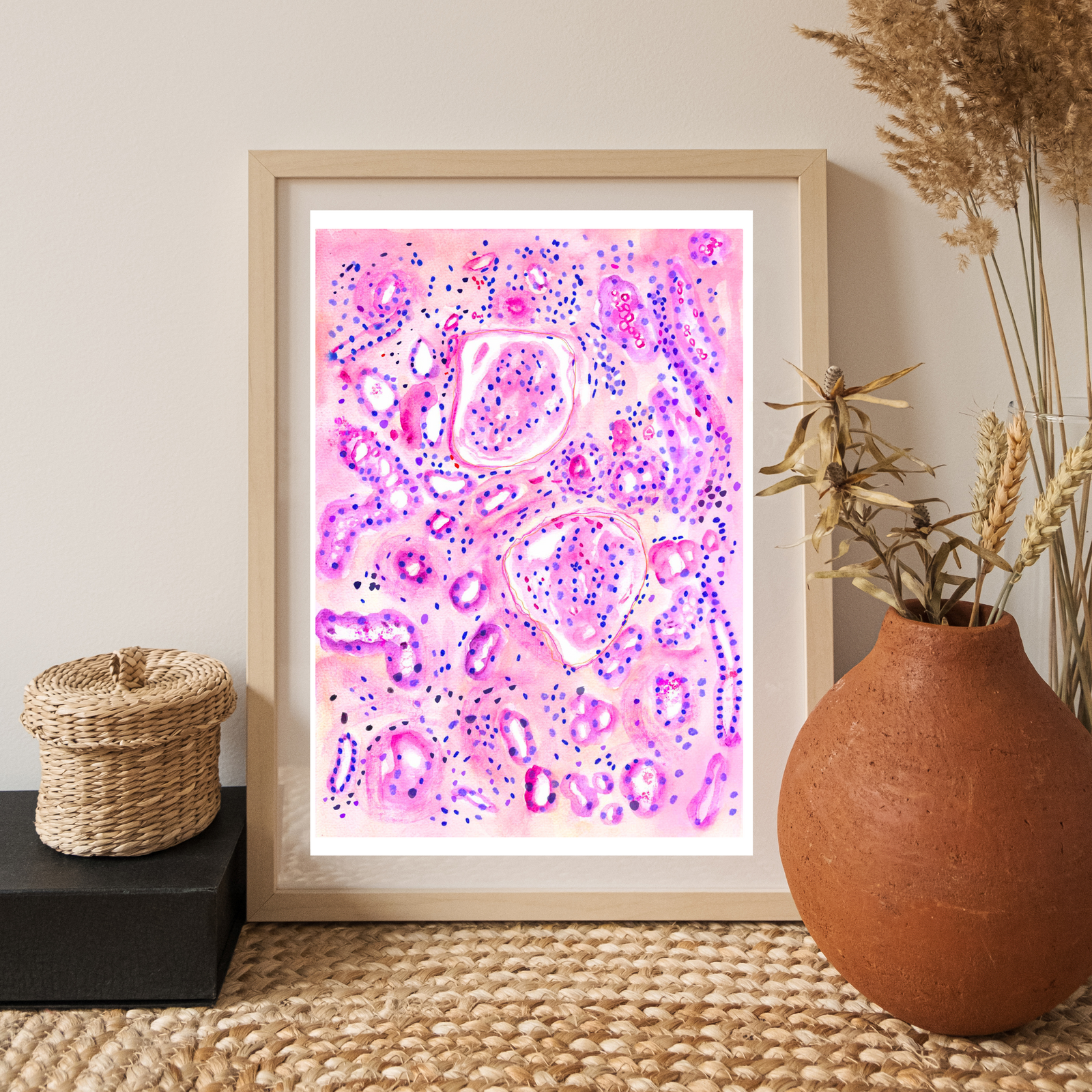 Diabetic Nephropathy Histopathology Watercolor Art Print