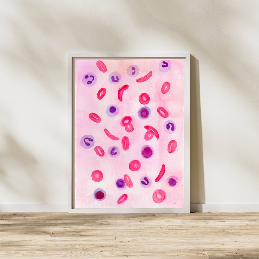 Sickle Cell Anemia Histopathology Art Print