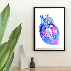 Transaortic Valve Replacement Watercolor Art Print