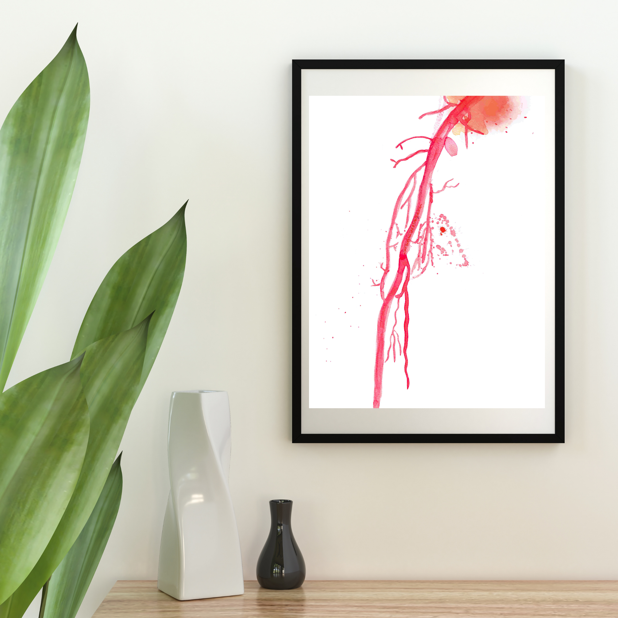 vascular ultrasound decor
