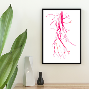 Angiography Femoral Spf Artery Occlusion Anatomy Art Print