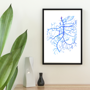 Mesenteric Arteries Angiography