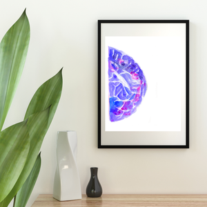 Mammogram Watercolor Art Print