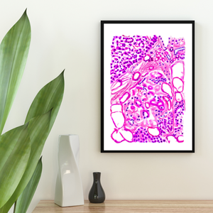 Diabetes Art, Pathology Art, Histopathology Art, Pathology Assistant, Diabetes type 2, Pathologist Gifts, Diabetes Poster, Pancreas