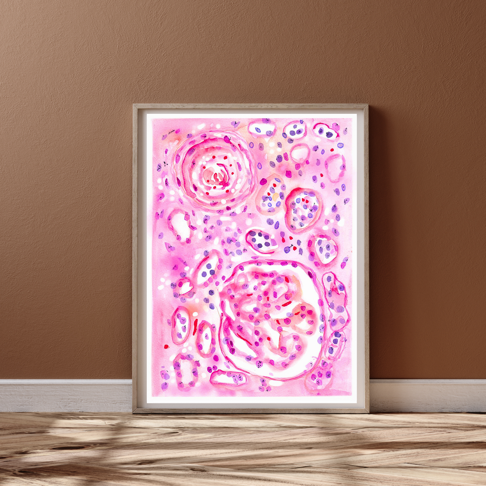 Malignant Nephrosclerosis Histopathology Art