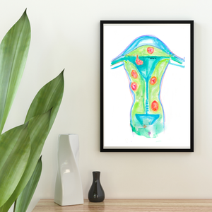 Uterine Fibroids Art Print for OBGYN Offices