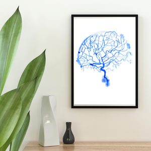 Cerebral Angiography Watercolor Art Print