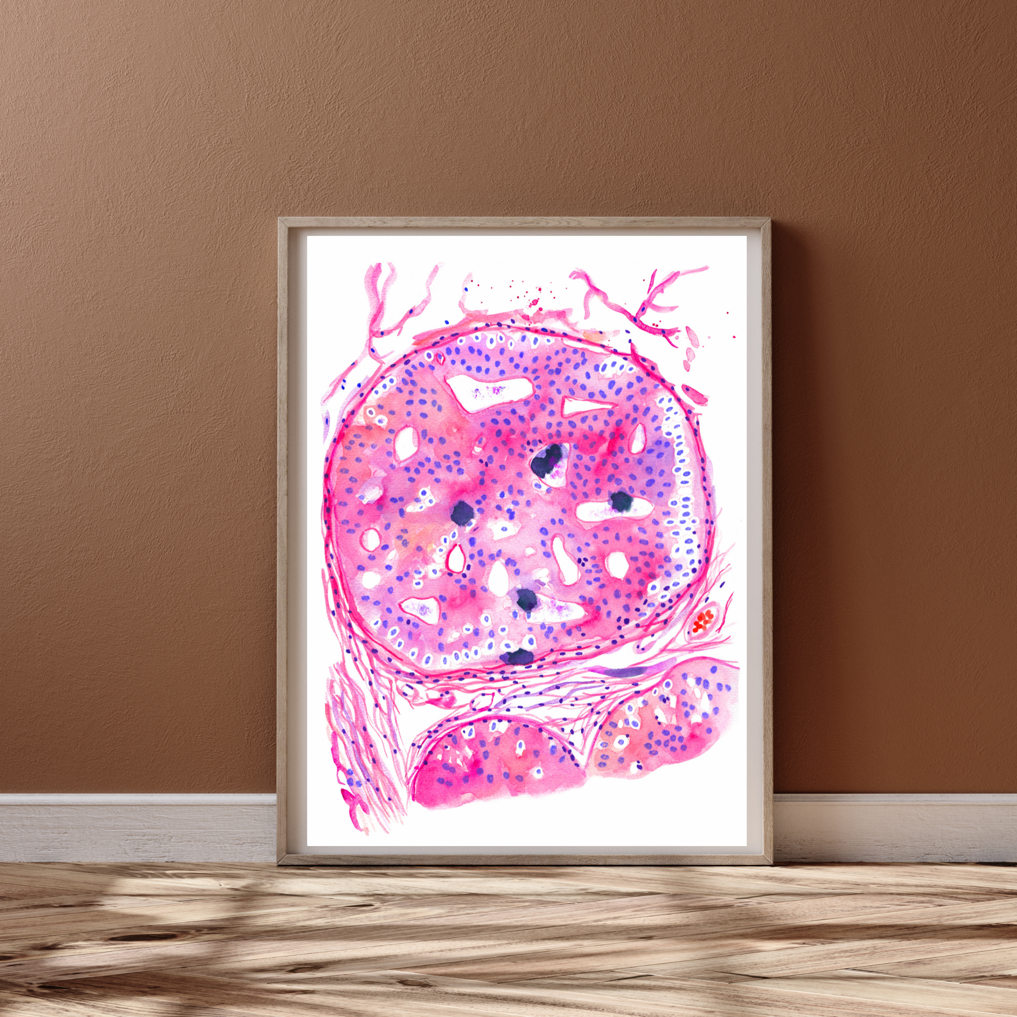 Breast Cancer Histopathology Art - DCIS