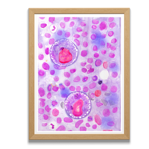 Hodgkin Lymphoma Watercolor Art Print