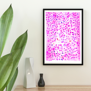 Large B Cell Lymphoma with IRF4 Oncohematology Art Print