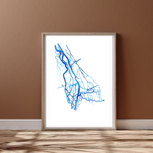Upper Limb DSA, Vascular Surgery Radiology Art Print