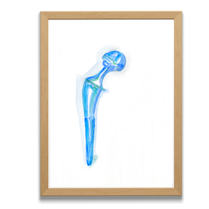 Hip Implant Watercolor Art Print