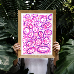 Colon Polyp - Tubular Adenoma Histopathology Art