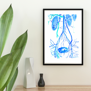 Pelvic Congestion Syndrome Venography Watercolor Art Print