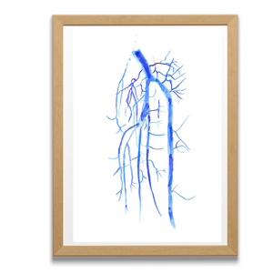 Popliteo-tibial Angiography Art Print