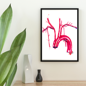 Aorta Anatomy Art Print