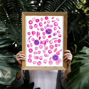 Sickle Cell Anemia Art Print