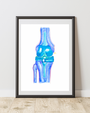 Knee Replacement Orthopedic Surgery Art