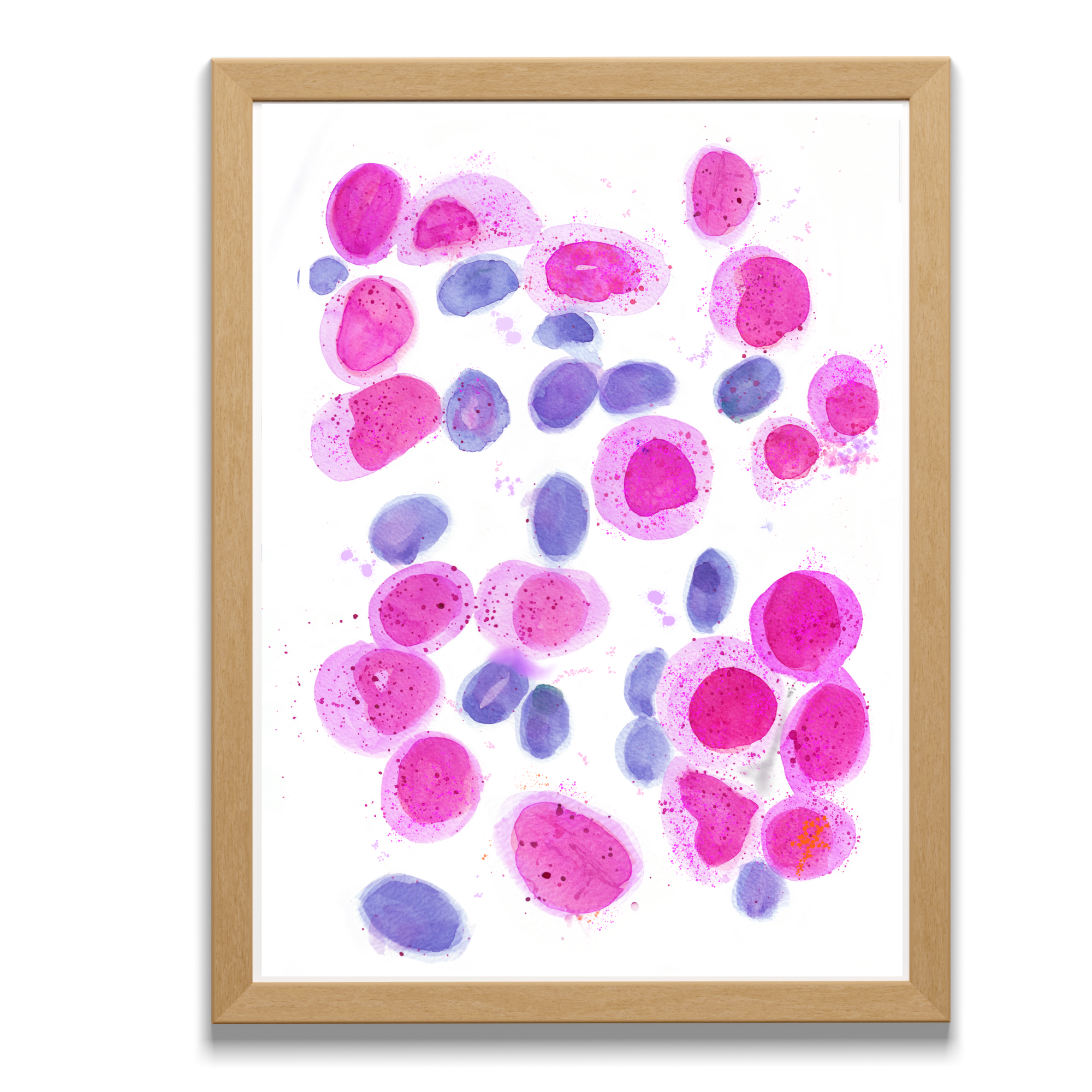 acute myeloid leukemia art
