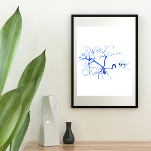 Celiac Trunk Arteriogram Interventional Radiology Vascular Gastroenterology Surgery Art Print