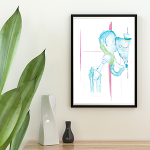 Hip Replacement Orthopedic Anatomy Art