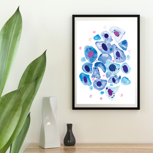 Bronchial Wash Pathology, Pulmonology Art Print