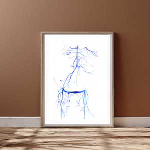 Crossover iliac artery bypass