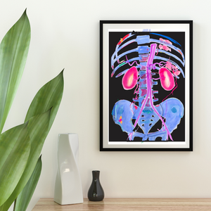 Abdominal CTA Aorta, Kidney Vascular Abstract Anatomy Art Print