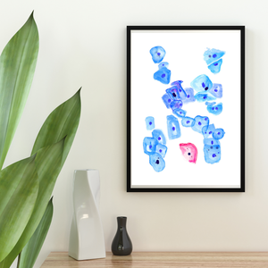 Cervix Cytology Gynecopathology Art