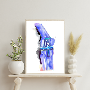 Knee Replacement Orthopedic Surgery Art Print