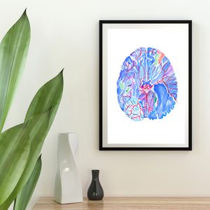 Circle of Willis Brain Anatomy Art Print