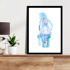 Knee Replacement Surgery Art Print, Orthopedic Surgery Wall Art