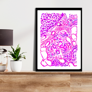 Diabetes Art, Pathology Art, Histopathology Art, Pathology Assistant, Diabetes type 2, Pathologist Gifts, Diabetes Poster, Pancreas