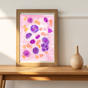 Multiple Myeloma Histopathology Art