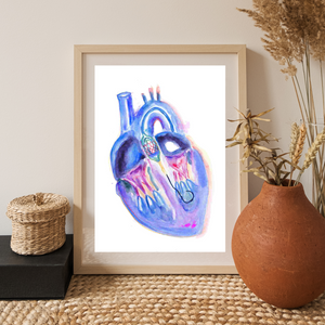 Transaortic Valve Replacement Watercolor Art Print