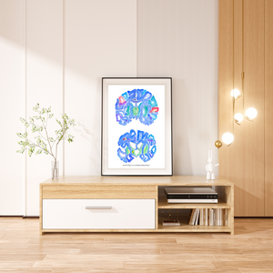 Alzheimer brain gross pathology illustration