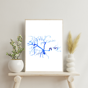 Celiac Trunk Arteriogram Interventional Radiology Vascular Gastroenterology Surgery Art Print